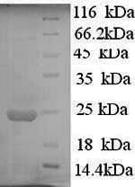 Recombinant Human Interferon alpha-10 (IFNA10) – Figure 1 of 1
