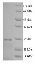 Recombinant Human Interferon alpha-14 (IFNA14) – Figure 1 of 1