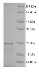 Recombinant Human Interferon alpha-14 (IFNA14) – Figure 1 of 1
