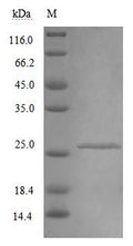 Recombinant Mouse Interferon alpha/beta receptor 2 (Ifnar2), partial – Figure 1 of 1