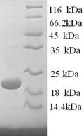 Recombinant Sheep Interferon gamma (IFNG) – Figure 1 of 1