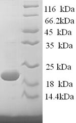 Recombinant Sheep Interferon gamma (IFNG) – Figure 1 of 1