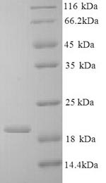 Recombinant Bovine Interleukin-10 (IL10) – Figure 1 of 1
