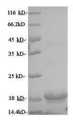 Recombinant Macaca mulatta Interleukin-10 (IL10) – Figure 1 of 1