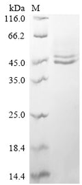 (Tris-Glycine gel) Discontinuous SDS-PAGE (reduced) with 5% enrichment gel and 15% separation gel.