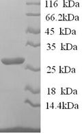 Recombinant Sheep Interleukin-12 subunit beta (IL12B) – Figure 1 of 1