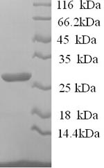 Recombinant Sheep Interleukin-12 subunit beta (IL12B) – Figure 1 of 1