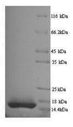 Recombinant Macaca mulatta Interleukin-15 (IL15) – Figure 1 of 1