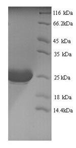 Recombinant Macaca mulatta Interleukin-1 alpha (IL1A) – Figure 1 of 1