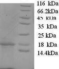 Recombinant Sheep Interleukin-1 beta (IL1B) – Figure 1 of 1