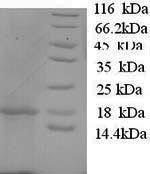 Recombinant Sheep Interleukin-1 beta (IL1B) – Figure 1 of 1