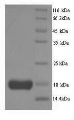 Recombinant Human Interleukin-2 (IL2) – Figure 1 of 1
