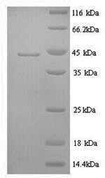 Recombinant Sheep Interleukin-6 (IL6) – Figure 1 of 1