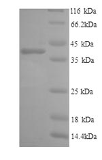 Recombinant Human Interleukin-6 receptor subunit alpha (IL6R), partial – Figure 1 of 1