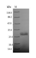 Recombinant Human Integrin alpha-IIb (ITGA2B), partial – Figure 1 of 1