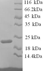 Recombinant Mouse Integrin alpha-L (Itgal), partial – Figure 1 of 1