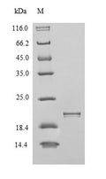 Recombinant Human Integrin alpha-V (ITGAV), partial – Figure 1 of 1