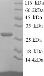 Recombinant Human Junctional adhesion molecule B (JAM2), partial – Figure 1 of 1