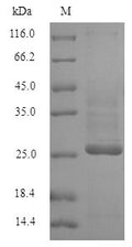 Recombinant Human Potassium voltage-gated channel subfamily D member 1 (KCND1), partial – Figure 1 of 1