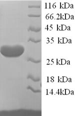 Recombinant Human A-type voltage-gated potassium channel KCND2 (KCND2), partial – Figure 1 of 1