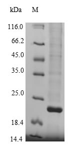 Recombinant Human Lysine-specific demethylase 5A (KDM5A), partial – Figure 1 of 1