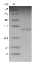 Recombinant Rat Kinesin-like protein KIF1C (Kif1c), partial – Figure 1 of 1