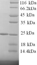 Recombinant Human Kallikrein-7 (KLK7), partial – Figure 1 of 1