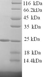 Recombinant Human Kallikrein-7 (KLK7), partial – Figure 1 of 1