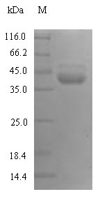 (Tris-Glycine gel) Discontinuous SDS-PAGE (reduced) with 5% enrichment gel and 15% separation gel.