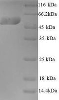 Recombinant Human Kynurenine 3-monooxygenase (KMO) – Figure 1 of 1