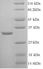 Recombinant Rat Kininogen-1 (Kng1), partial – Figure 1 of 1
