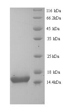 Recombinant Human KeRatin, type I cytoskeletal 10 (KRT10), partial – Figure 1 of 1