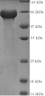 Recombinant Human KeRatin, type I cytoskeletal 14 (KRT14) – Figure 1 of 1