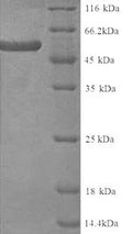 Recombinant Human KeRatin, type II cytoskeletal 4 (KRT4) – Figure 1 of 1
