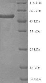 Recombinant Human KeRatin, type II cytoskeletal 4 (KRT4) – Figure 1 of 1