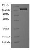 Recombinant Human Plastin-2 (LCP1) – Figure 1 of 1