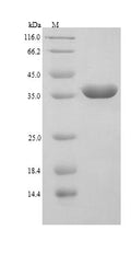 (Tris-Glycine gel) Discontinuous SDS-PAGE (reduced) with 5% enrichment gel and 15% separation gel.