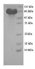 Recombinant Human Leucine-rich repeat-containing G-protein coupled receptor 5 (LGR5), partial – Figure 1 of 1