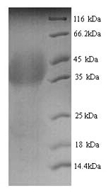 Recombinant Human Lutropin-choriogonadotropic hormone receptor (LHCGR), partial – Figure 1 of 1