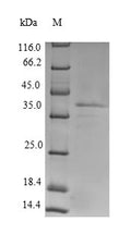 Recombinant Rat Lutropin-choriogonadotropic hormone receptor (Lhcgr), partial – Figure 1 of 1