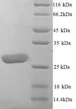 Recombinant Human Leukocyte immunoglobulin-like receptor subfamily A member 5 (LILRA5), partial – Figure 1 of 1