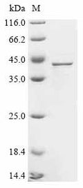 (Tris-Glycine gel) Discontinuous SDS-PAGE (reduced) with 5% enrichment gel and 15% separation gel.