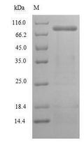 Recombinant Mouse Lysyl oxidase homolog 2 (Loxl2) – Figure 1 of 1