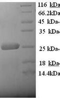 Recombinant Human Low-density lipoprotein receptor-related protein 2 (LRP2), partial – Figure 1 of 1