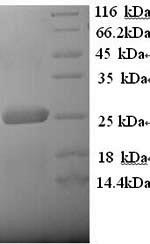 Recombinant Human Low-density lipoprotein receptor-related protein 2 (LRP2), partial – Figure 1 of 1