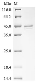 (Tris-Glycine gel) Discontinuous SDS-PAGE (reduced) with 5% enrichment gel and 15% separation gel.