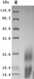 Recombinant Human Lymphocyte antigen 6 complex locus protein G6d (LY6G6D) (Active) – Figure 1 of 1