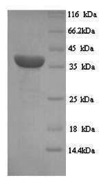 Recombinant Human Melanoma-associated antigen 1 (MAGEA1) – Figure 1 of 1