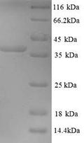 Recombinant Mouse Microtubule-associated protein 2 (Map2), partial – Figure 1 of 1