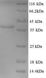 Recombinant Mouse Microtubule-associated protein 2 (Map2), partial – Figure 1 of 1